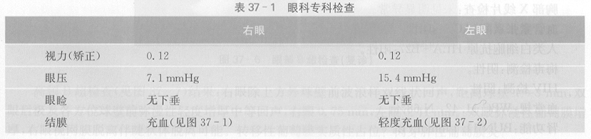 ZY016_193_1.gif